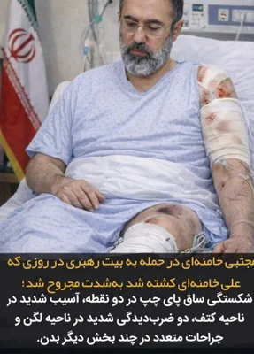@Eli Afriat 🇮🇱: 🚨🇮🇷BREAKING: IRNA News: Mojtaba Khamenei was seriously injured in an attack on the leader's residence on the day his father Ali Khamenei was ELIMINATED. 

His left leg is broken, his shoulder area 