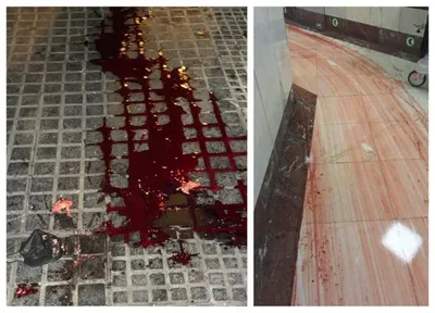 @𝐍𝐢𝐨𝐡 𝐁𝐞𝐫𝐠 🇮🇷 ✡︎: This was Iran during "peacetime" by the way. The image on the left is the street. The image on the right is a hospital floor.

A ceasefire for you does not mean ceasefire for the people trapped with t